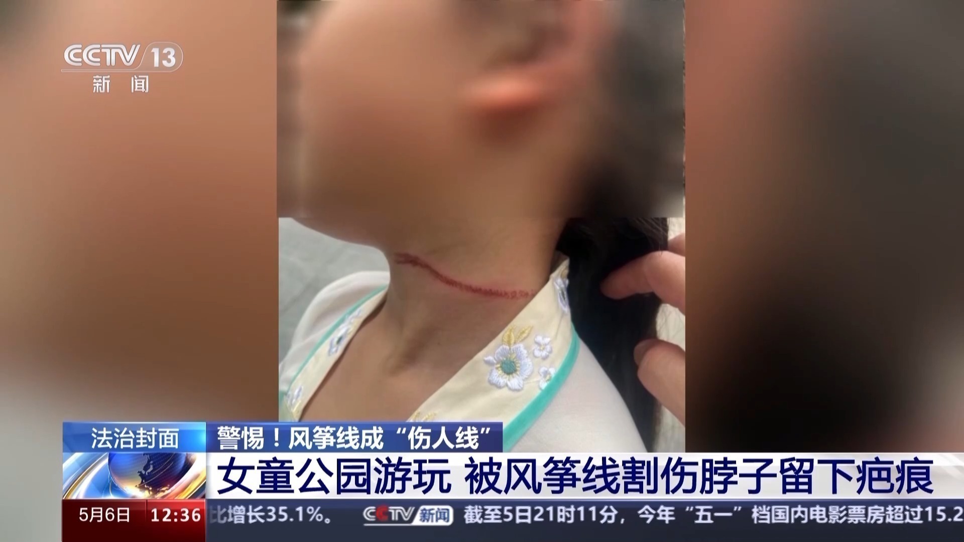 风筝线何以成“隐形刀”?平安放飞有讲究→ 风筝线何以成“隐形刀”?平安放飞有讲究→