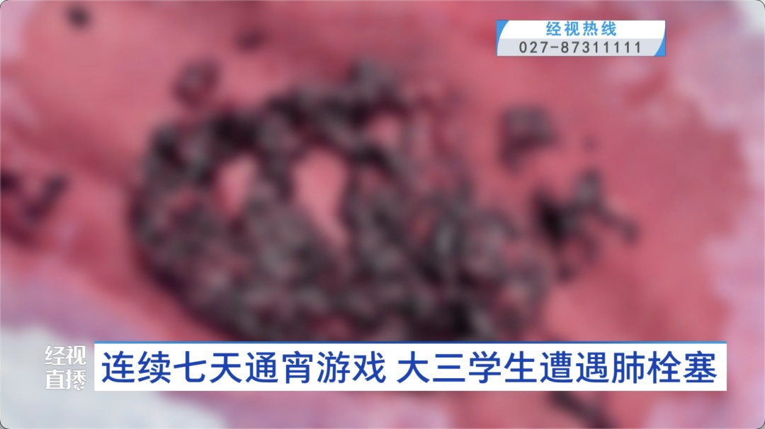 不到一个小时就会猝死！大学生突发凶险疾病 这些都是高危人群
