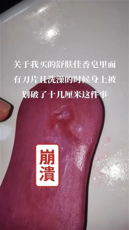 知名香皂内再现刀片消费者被划伤10余厘米？最新回应