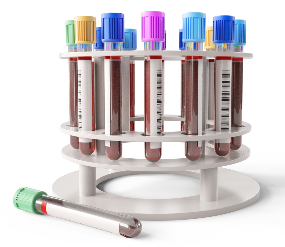 讲讲抽血那些事儿