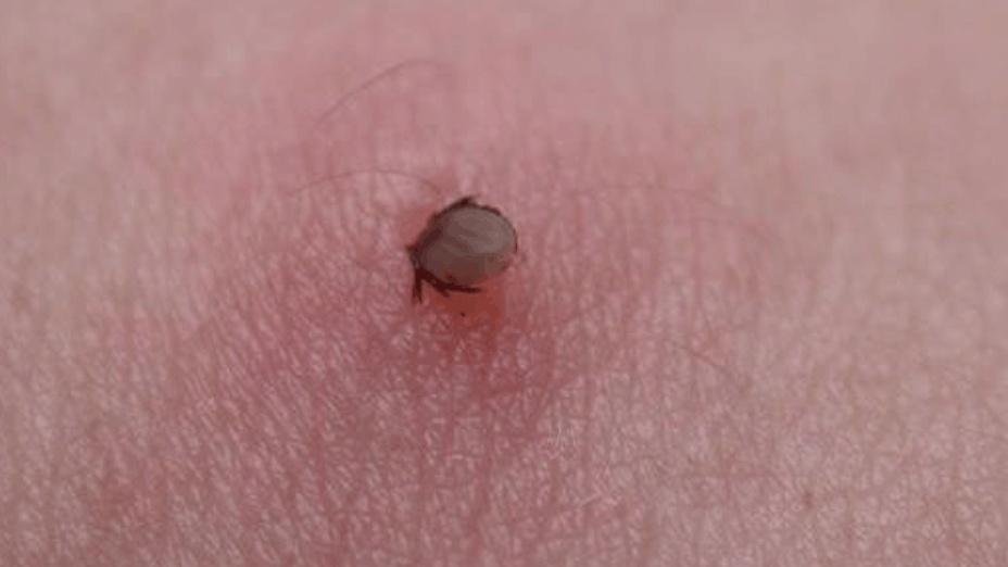 进入流行季!目前无针对性疫苗!江苏疾控提醒 进入流行季!目前无针对性疫苗!江苏疾控提醒