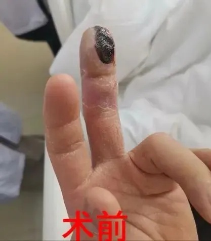 不少人的心头爱，突然登顶热搜！一地疾控提醒：已有多人中招