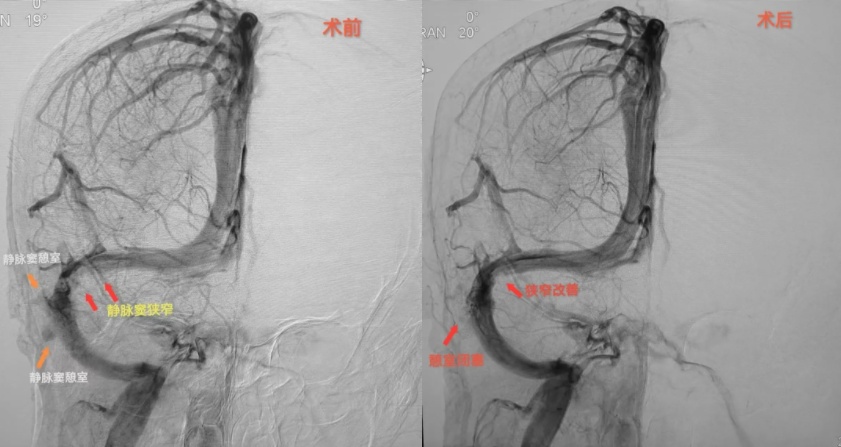 上海阿姨吓坏了！每天都能听到救护车声音？原因意外了…
