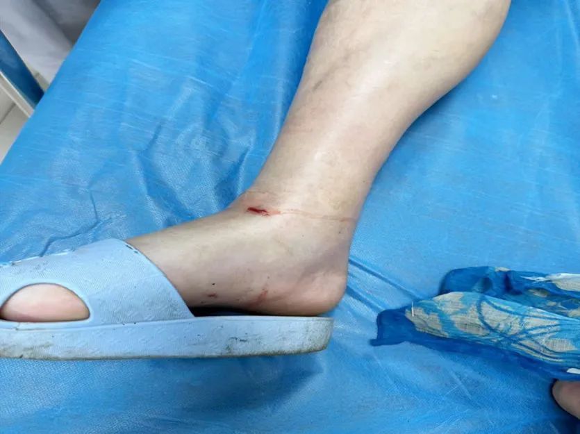 警惕!杭州女子不慎家门口中招,有剧毒 警惕!杭州女子不慎家门口中招,有剧毒