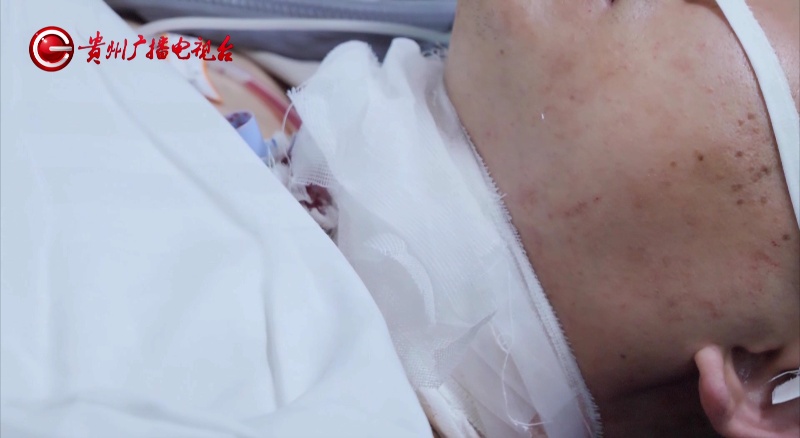 看着都疼！贵阳男子骑车回家险被“割喉”，罪魁祸首太常见……