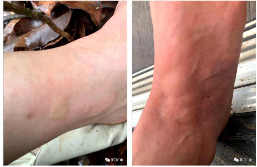 警惕！福建3岁男孩差点丧命！千万别碰！