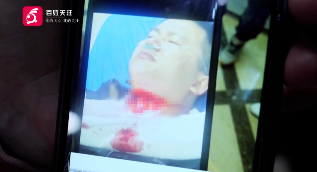 看着都疼！贵阳男子骑车回家险被“割喉”，罪魁祸首太常见……