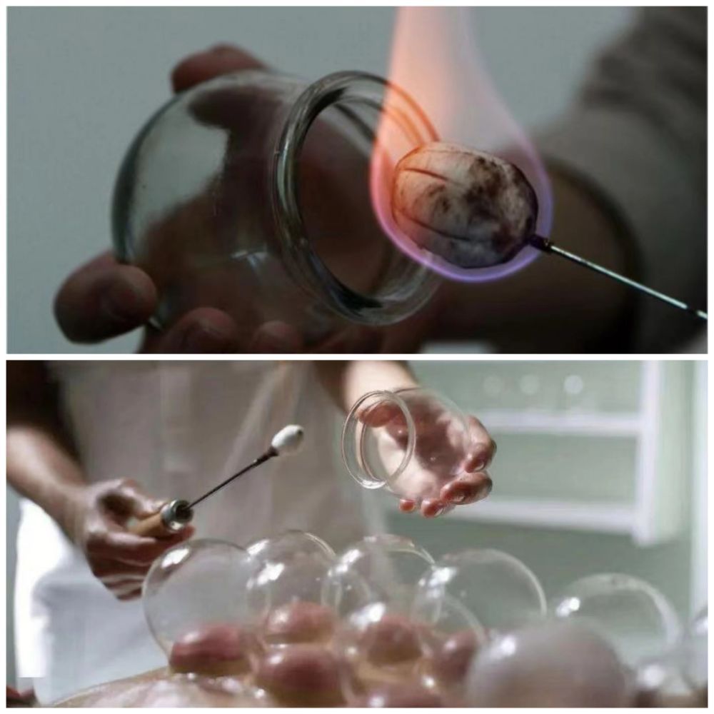 中医药进校园，竟从奥运赛场讲起