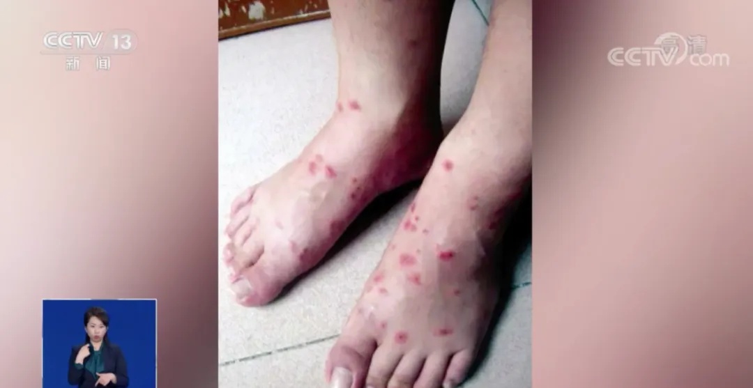 剧毒!小心! 剧毒!小心!