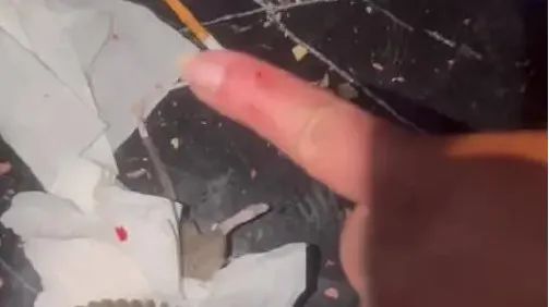 男子KTV包厢唱歌被老鼠咬伤,老板:正常成年人为啥徒手抓鼠? 男子KTV包厢唱歌被老鼠咬伤,老板:正常成年人为啥徒手抓鼠?