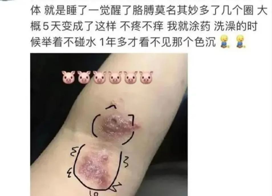 它已进入活跃期，很多人遭受袭击！