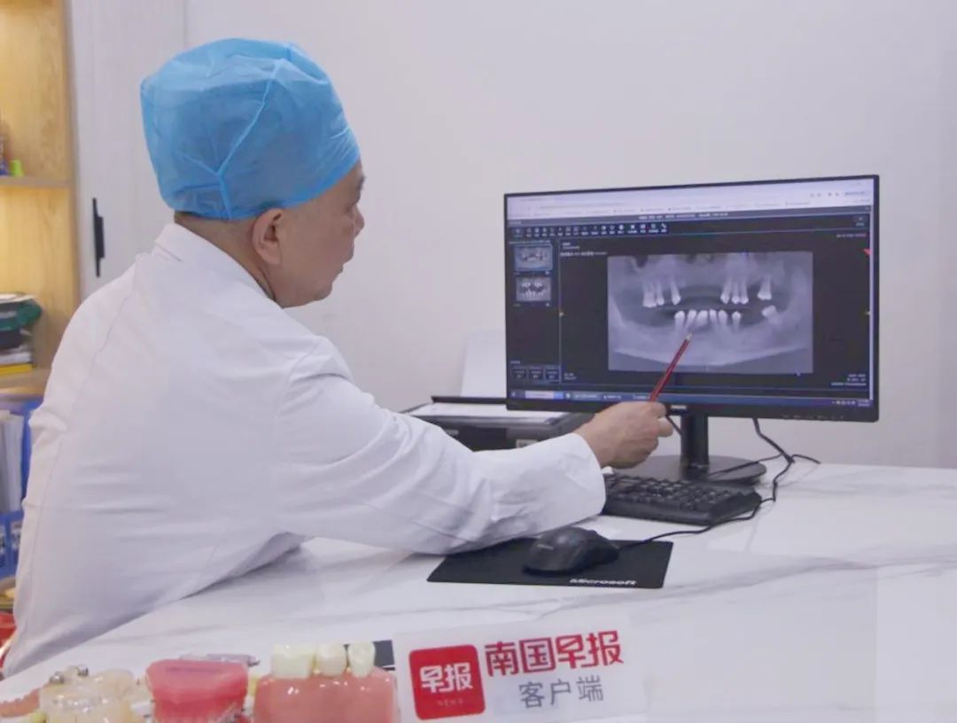 36岁男子6年掉半口牙,医生:剩下的也保不住了 36岁男子6年掉半口牙,医生:剩下的也保不住了