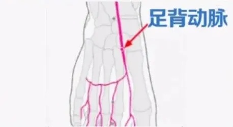 血管好不好,摸这里就知道!专家推荐餐桌上5大血管“清道夫” 血管好不好,摸这里就知道!专家推荐餐桌上5大血管“清道夫”