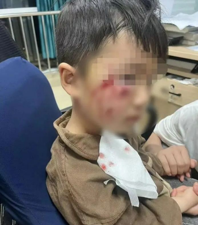 "中枢神经快死完了"！全网揪心，孩子18天后还是走了…
