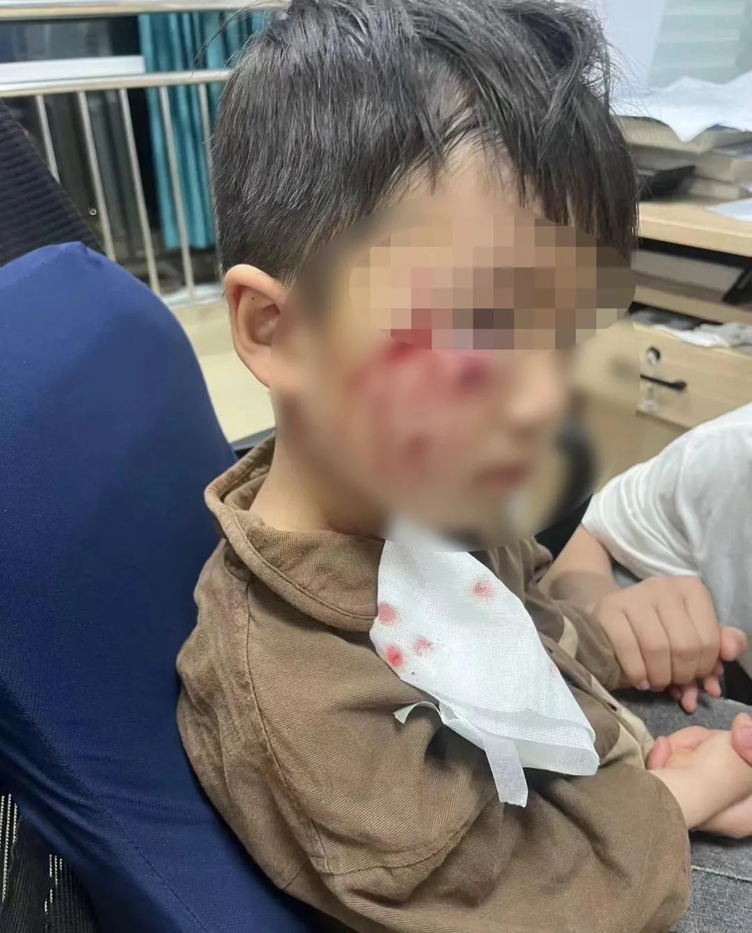 3岁男童被恶犬咬伤，打了疫苗后仍不幸离世！母亲：没找到狗主人