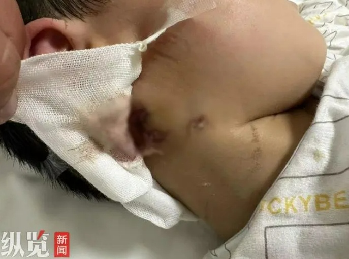 "中枢神经快死完了"！全网揪心，孩子18天后还是走了…