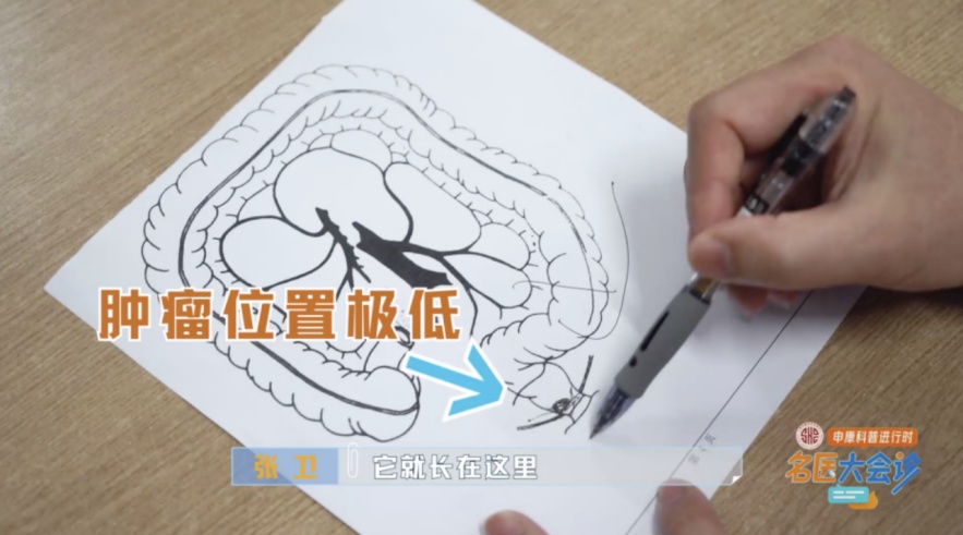 有人便血一年多,到医院一查吓坏了!死亡率极高 有人便血一年多,到医院一查吓坏了!死亡率极高