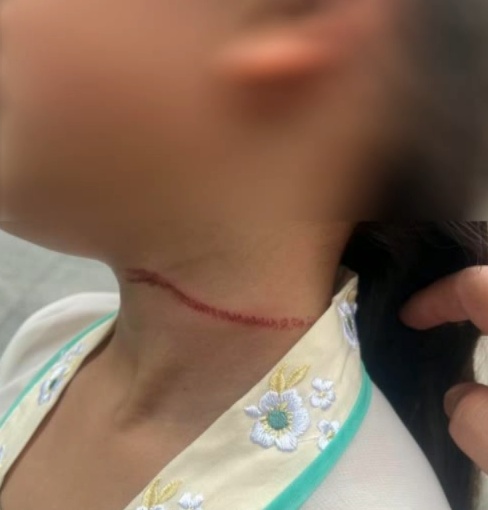 十分危险！有人已被割伤脖子！