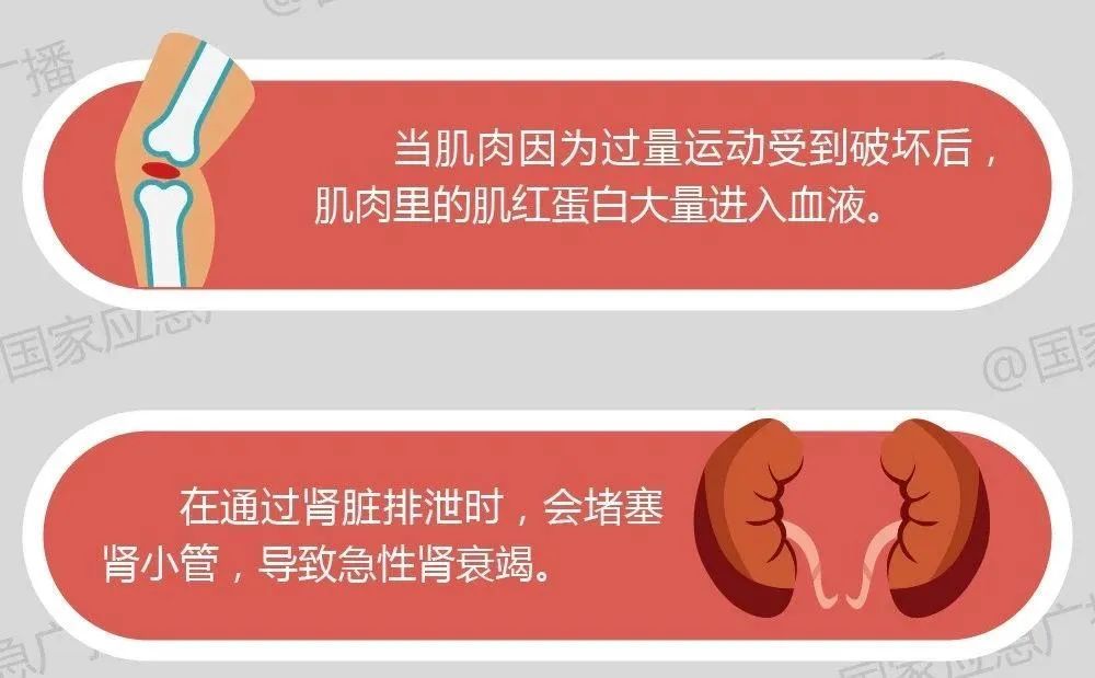 五旬男子,因这种锻炼方式意外身亡!这些健身误区你中了几条? 五旬男子,因这种锻炼方式意外身亡!这些健身误区你中了几条?