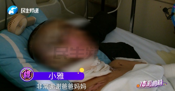 警惕！一家人吃烧烤，孩子被烧伤！千万别用它点火！