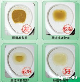 关于胃肠镜检查的小TIPS！