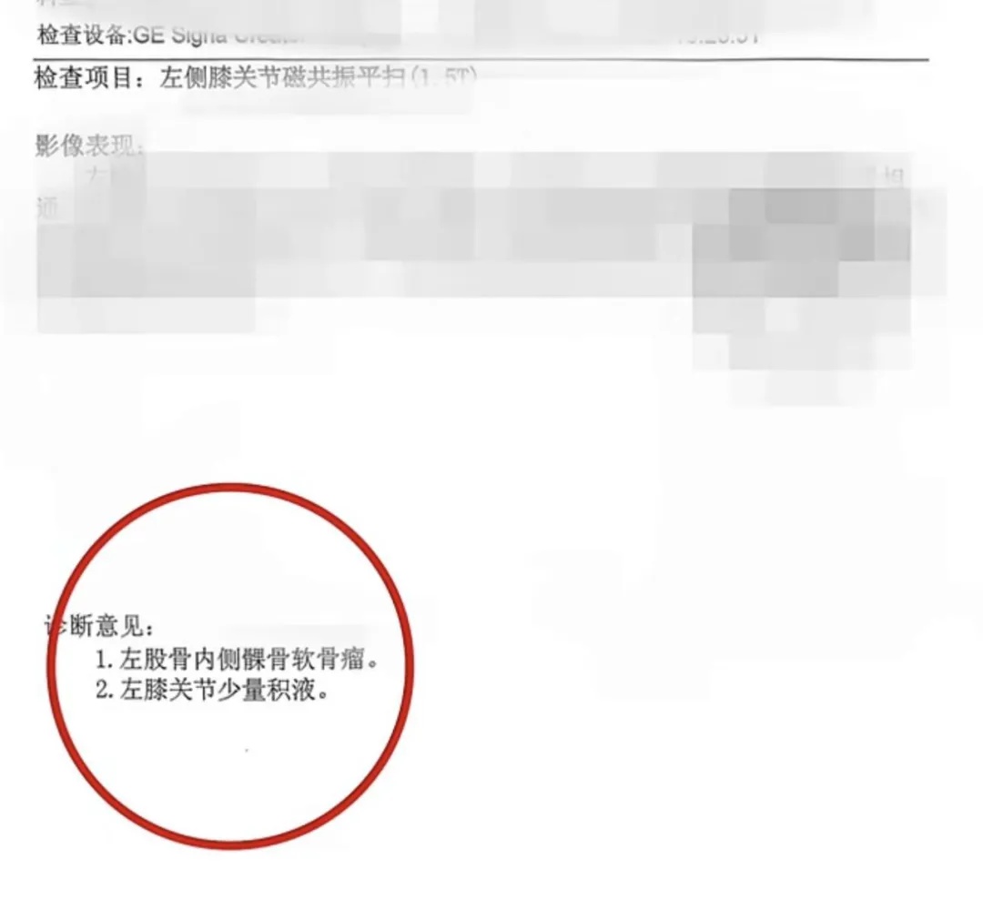 体育生左膝长骨瘤医生错切右膝!医院通报:6人被处理 体育生左膝长骨瘤医生错切右膝!医院通报:6人被处理