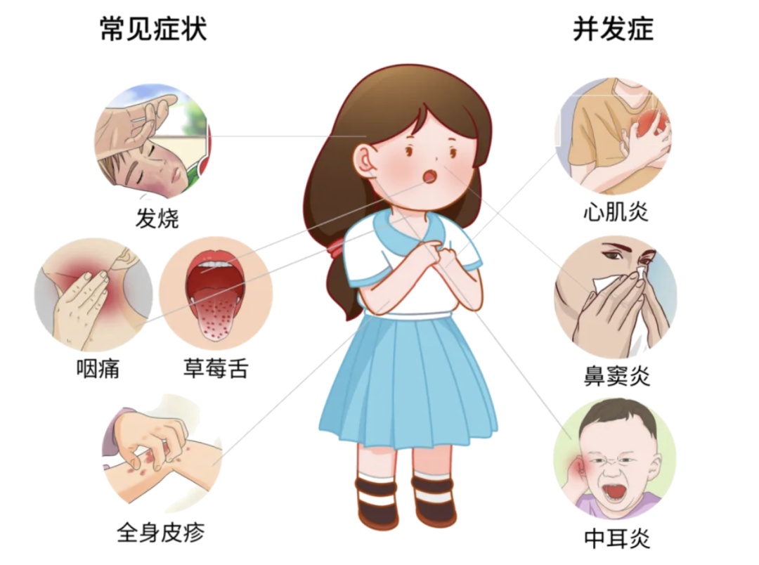 发烧、嗓子疼,警惕这两种疾病—— 发烧、嗓子疼,警惕这两种疾病——