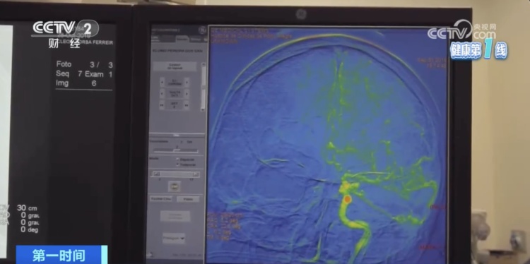 我国超1200万人患这种疾病！医生提示，出现这些信号要警惕
