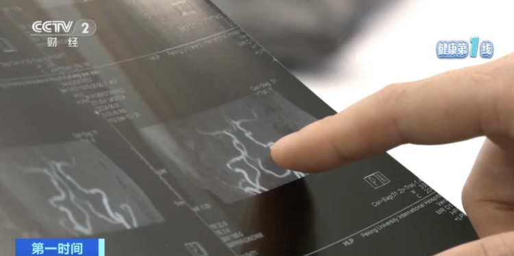 我国超1200万人患这种疾病！医生提示，出现这些信号要警惕