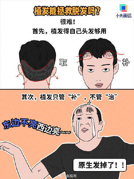 长期戴帽子会加重脱发