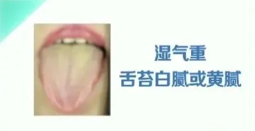 湿气重则百病生！夏天养生先祛湿，快停下这些“加湿”行为