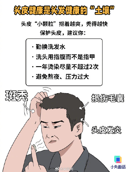 长期戴帽子会加重脱发