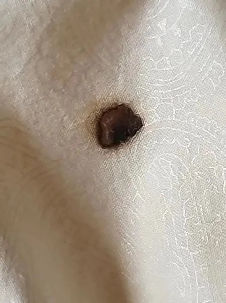 上海一小区频现高空抛烟头!禁令通知也被烫出洞,业主:就是挑衅 上海一小区频现高空抛烟头!禁令通知也被烫出洞,业主:就是挑衅