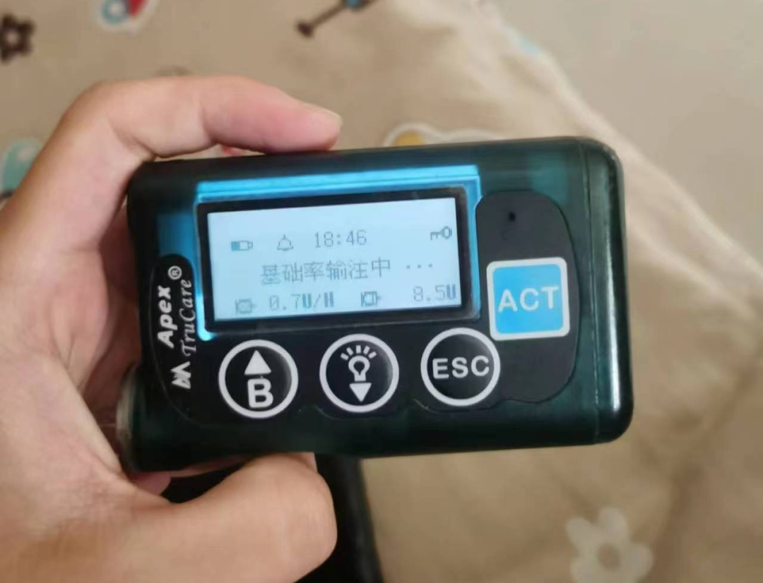 胰岛素泵丢在公园座椅上2小时后…… 胰岛素泵丢在公园座椅上2小时后……