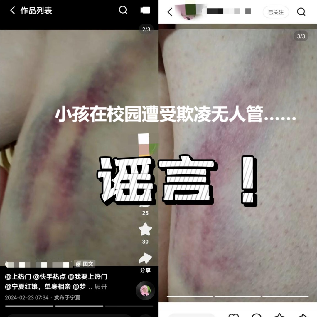 银川一家长捏造孩子在校园遭欺凌,竟是为了蹭流量! 银川一家长捏造孩子在校园遭欺凌,竟是为了蹭流量!