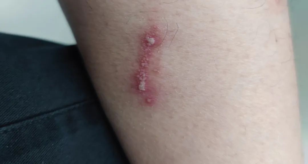 赶紧收手,千万别碰!杭州多地出现!很多人吃尽苦头,后果很严重... 赶紧收手,千万别碰!杭州多地出现!很多人吃尽苦头,后果很严重...