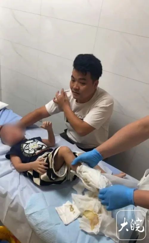 警惕这种病!2岁幼童摸鱼感染进ICU,右脚4根脚趾截肢 警惕这种病!2岁幼童摸鱼感染进ICU,右脚4根脚趾截肢