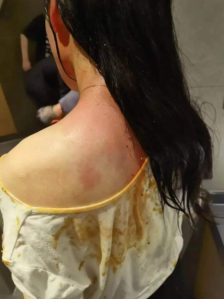 “女子被家暴16次，需终身挂粪袋”，法院判了！