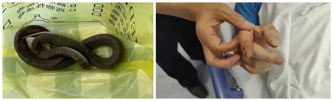 剧毒！女子听到敲门声，开门后瞬间吓呆！多地高发，提醒家人→