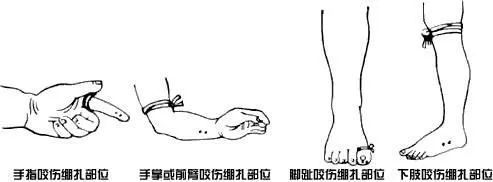 剧毒！女子听到敲门声，开门后瞬间吓呆！多地高发，提醒家人→