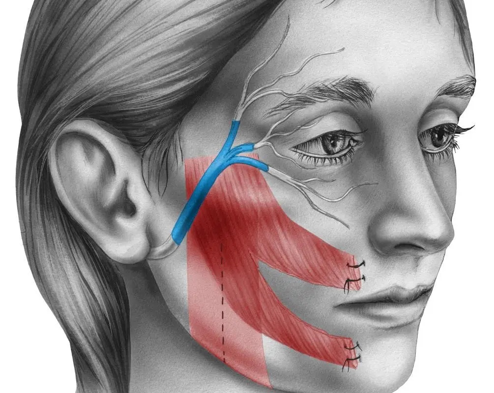 “吹空调吹出面瘫”?罪魁祸首竟是→ “吹空调吹出面瘫”?罪魁祸首竟是→
