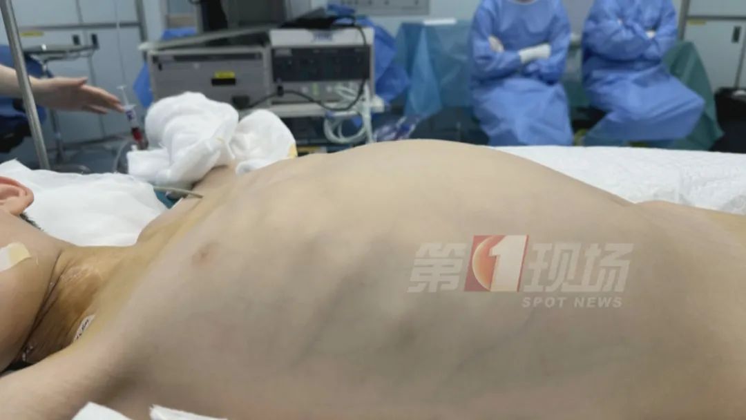 八岁娃得罕见病，肚大似孕妇！竟是20厘米巨大肿瘤……