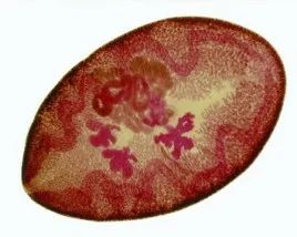 南京进入小龙虾上市季，吃小龙虾=吃寄生虫？真相揭露！