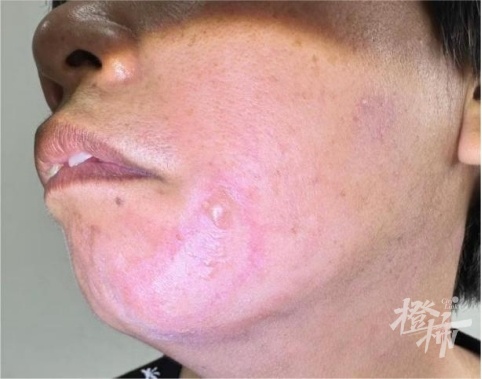 差点毁容，千万别碰！很多人都中过招…