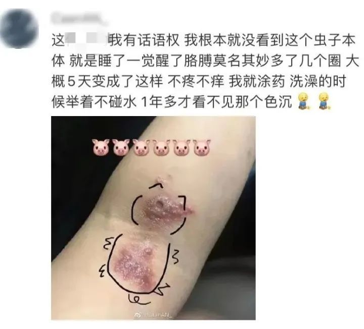 差点毁容，千万别碰！很多人都中过招…