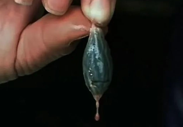 比砒霜还毒！男子吃了一口抢救2天，就藏在河南人常吃的这道菜里