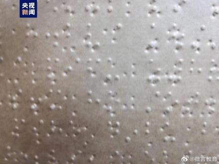 今年高考15名盲人考生使用盲文试卷