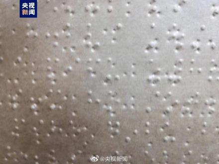 15名考生用盲文高考 15名考生用盲文高考