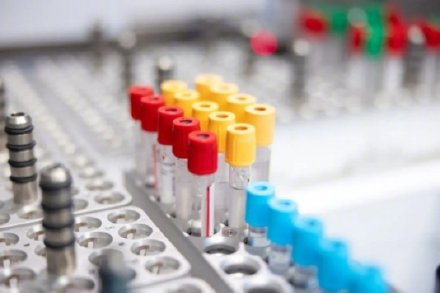 浙江温州发现一例比“熊猫血”更稀有的“恐龙血”,极为罕见 浙江温州发现一例比“熊猫血”更稀有的“恐龙血”,极为罕见