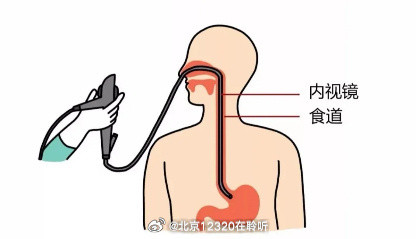 胃镜检查前，该做好什么准备？